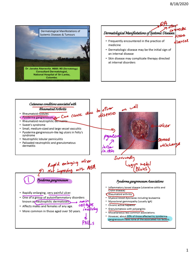 Dermatological Signs of Systemic Diseases | PDF | Melanoma | Skin