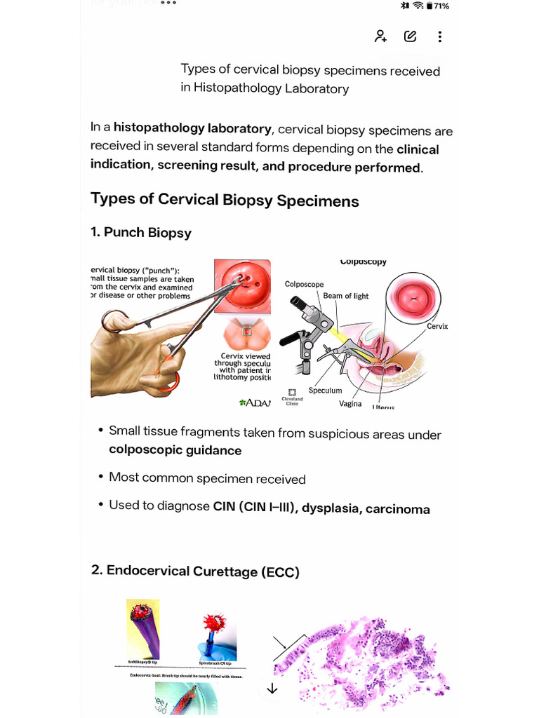 Specimens of Cervical Biopsy | PDF