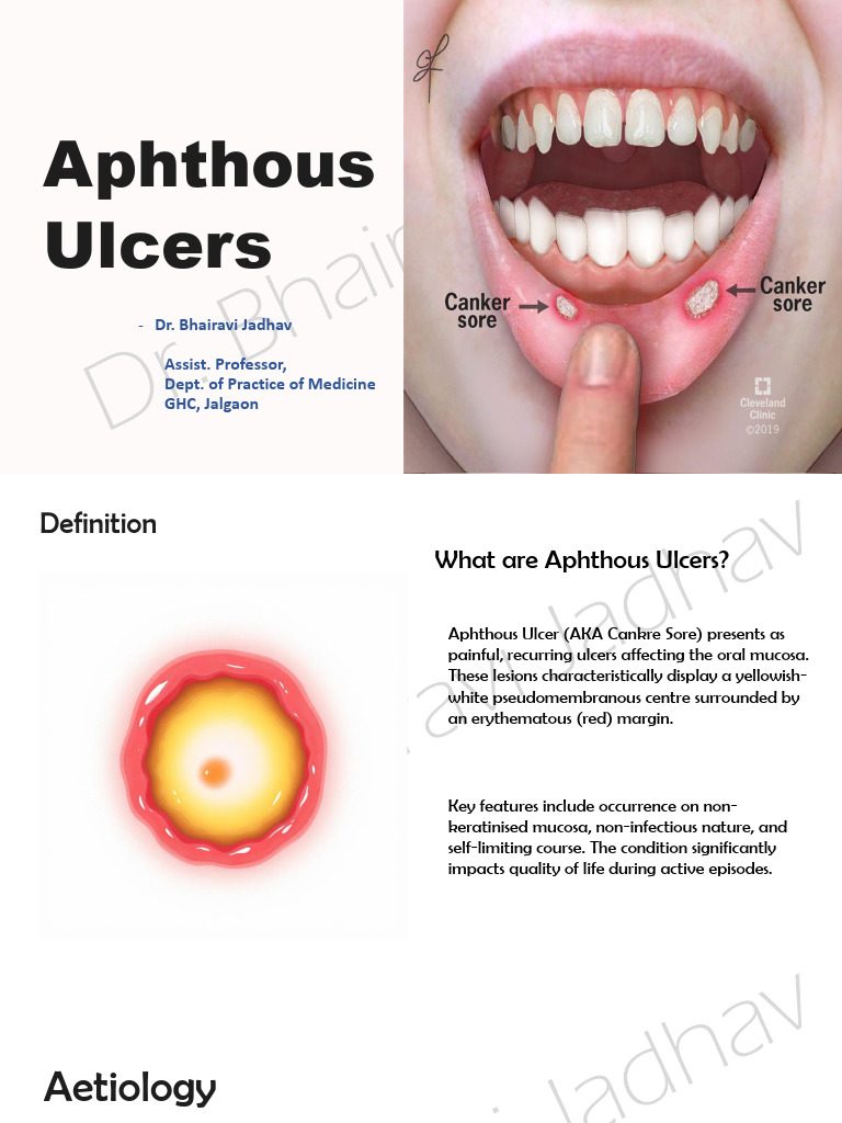 Aphthous-Ulcers BHMS-III | PDF | Medicine | Medical Specialties