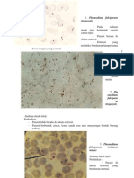 Plasmodium Falciparum 