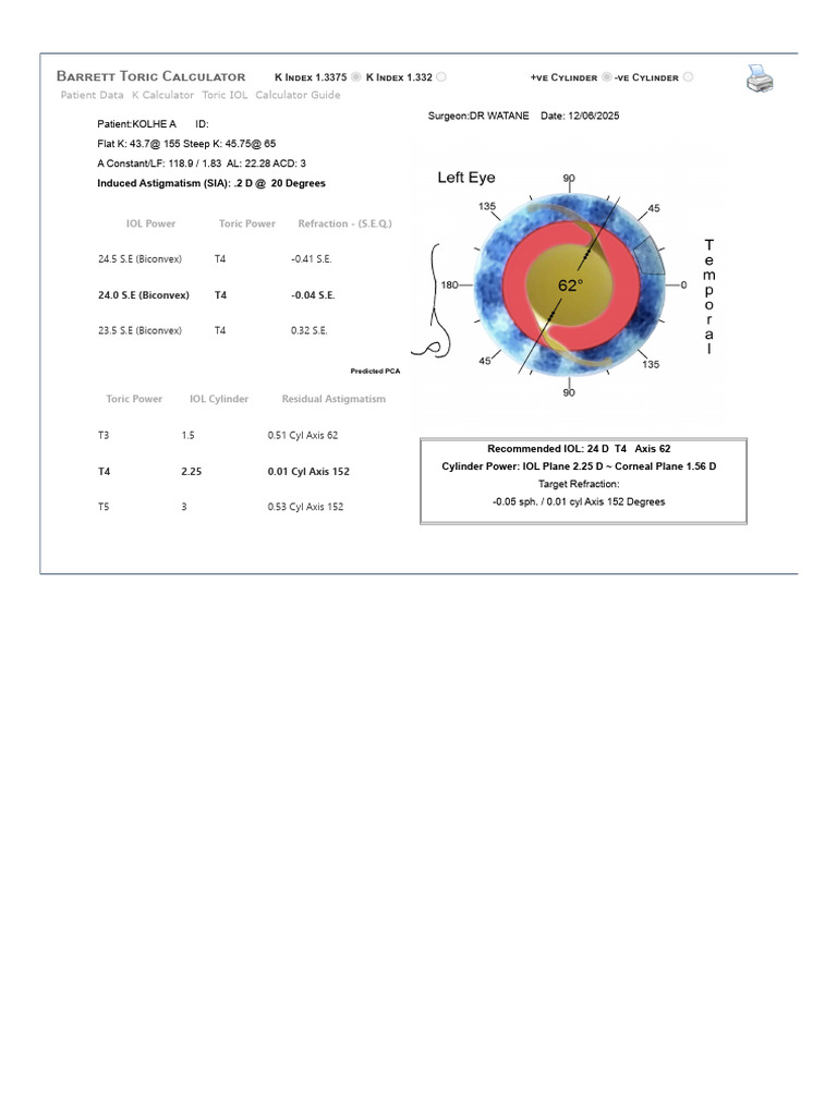 Barrett Toric IOL Calculator Guide | PDF
