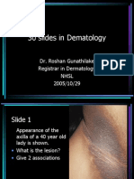30 Slides in Dematology: Dr. Roshan Gunathilake Registrar in Dermatology NHSL 2005/10/29