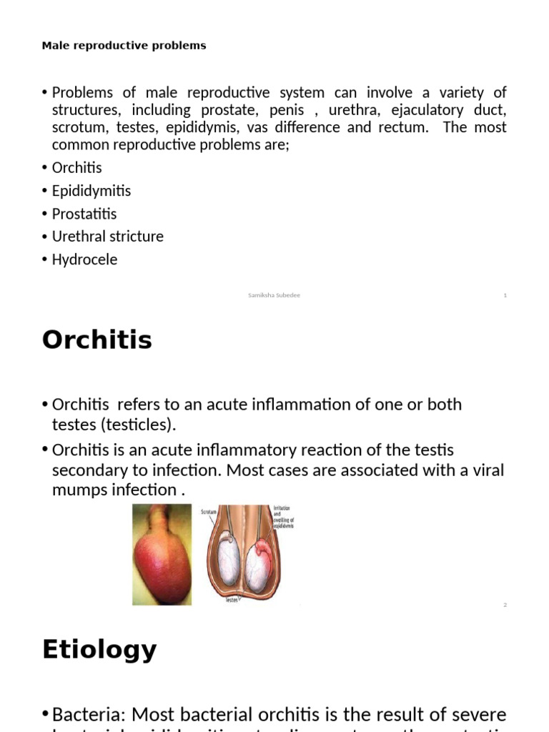 Male Reproductive System Disorders | PDF | Medical Specialties | Urology