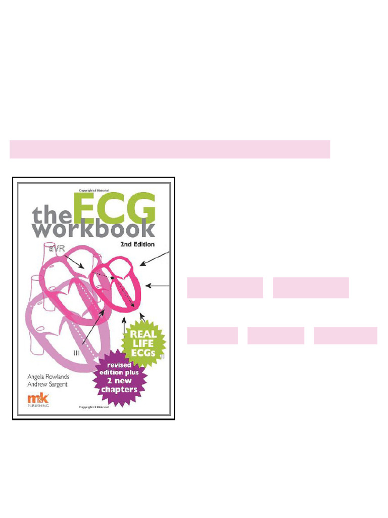 The Ecg Workbook 2nd Revised edition Edition Angela Rowlands No Waiting ...