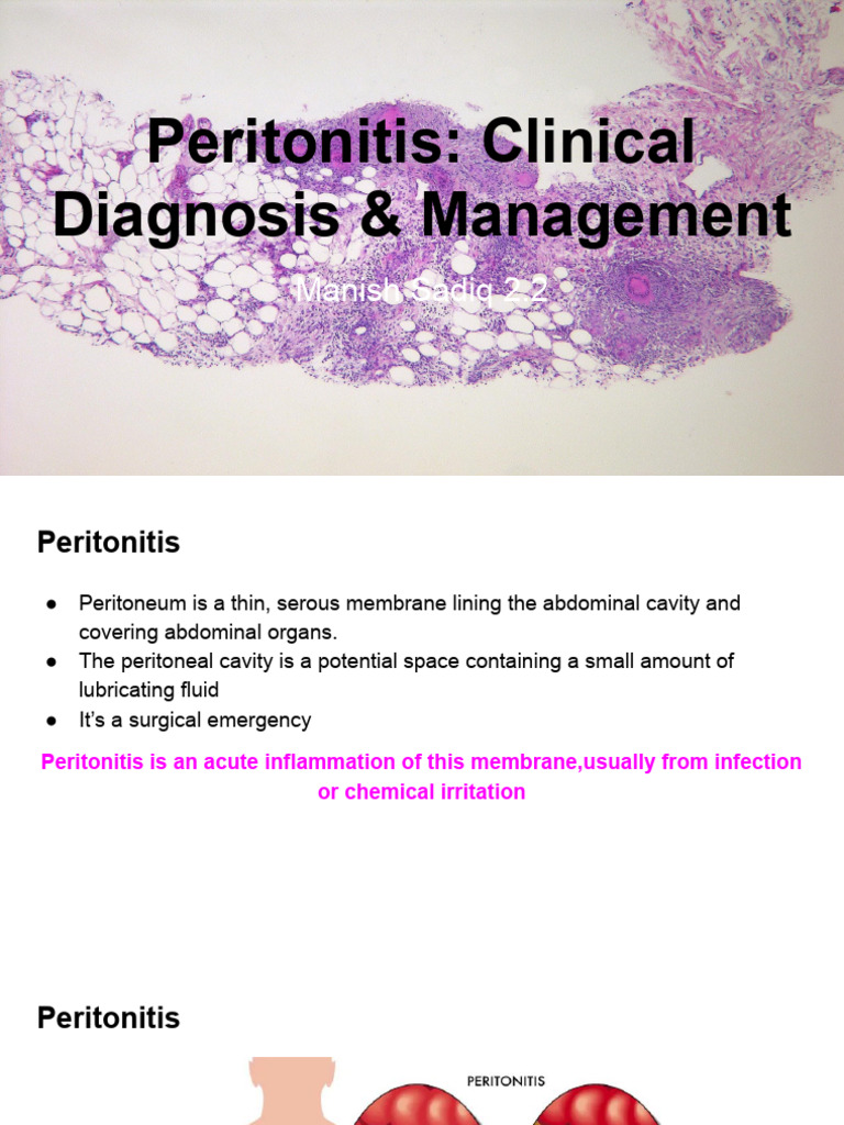 Peritonitis: Diagnosis and Management Guide | PDF | Peritoneum ...