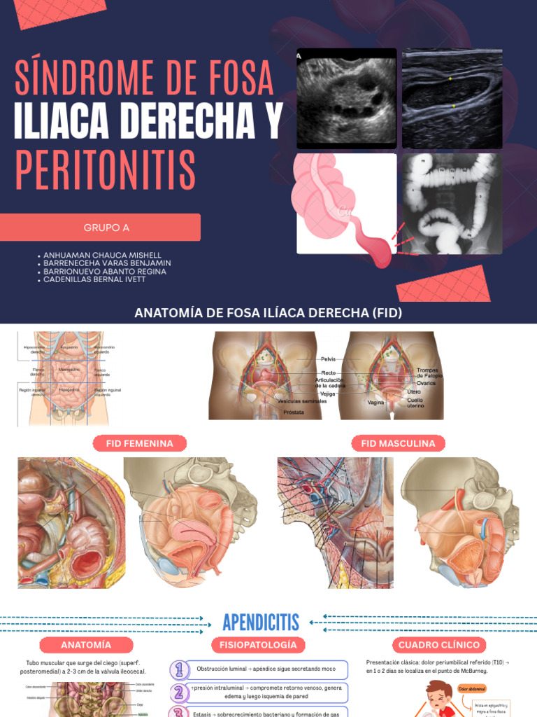 Clase 01. Síndrome de Fosa Ilíaca Derecha y Peritonitis - Grupo a (2