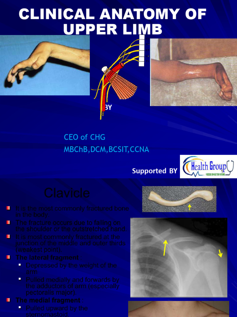 Upper Limb Clinical Anatomy Overview | PDF | Shoulder | Elbow