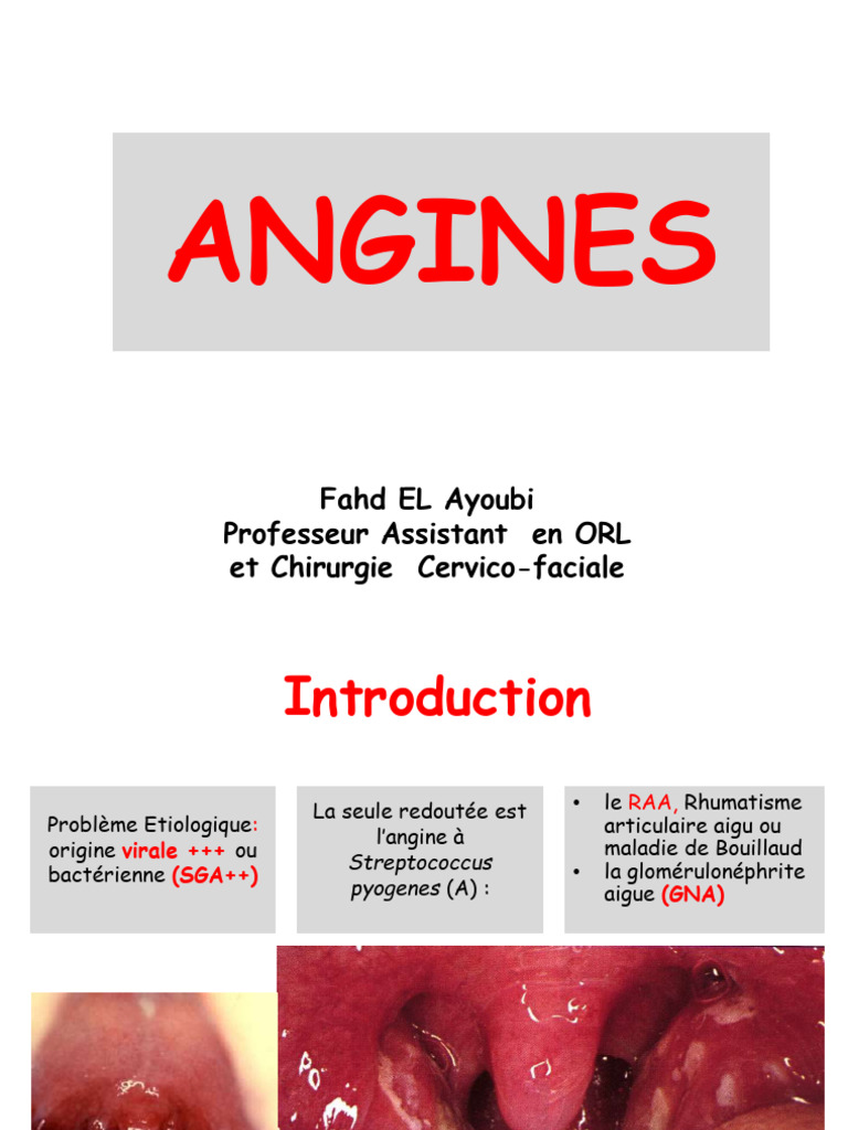 Comprendre les angines : types et traitements | PDF