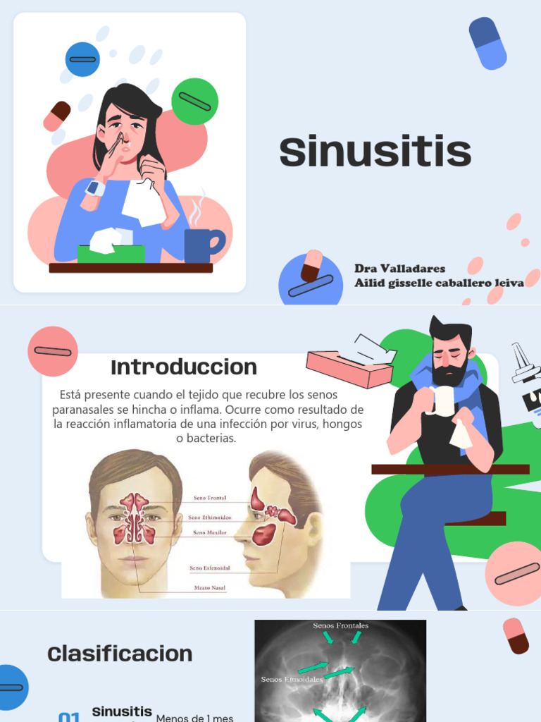 Guía Completa sobre Sinusitis | PDF | Enfermedades y trastornos ...
