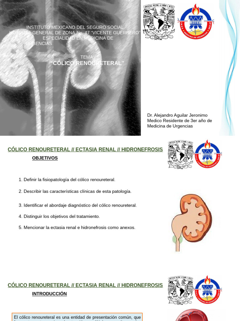 Colico Renal PDF Sistema Urinario Medicina