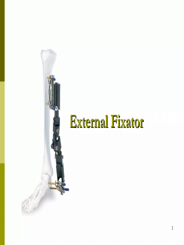 3.External Fixation 56 Pages | PDF