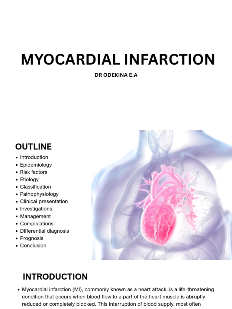 Myocardial Infarction | PDF | Myocardial Infarction | Coronary Artery ...