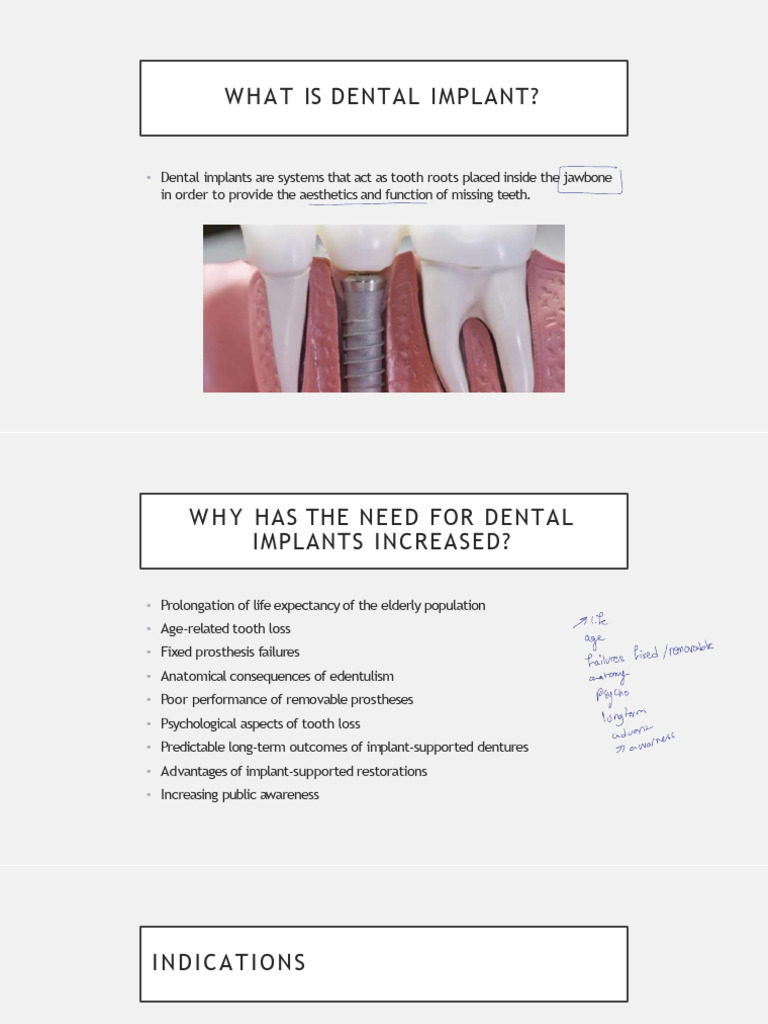 Understanding Dental Implants and Their Benefits | PDF | Dental Implant ...