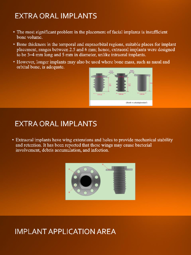 9-Dental Implants in the Rehabilitation | PDF | Dental Implant | Prosthesis
