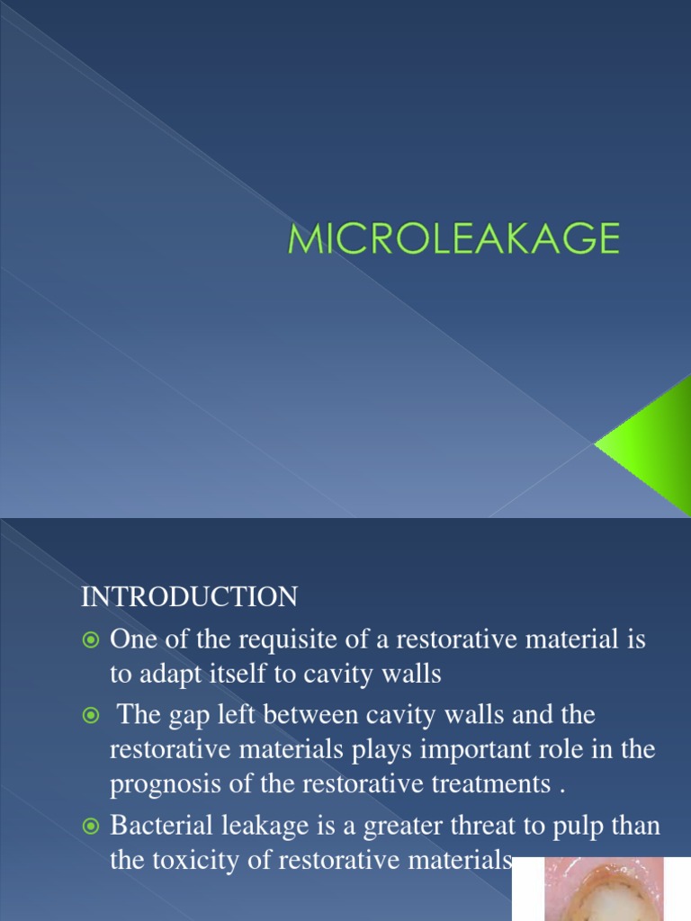 Microleakage Seminar PDF Dental Composite Tooth Enamel