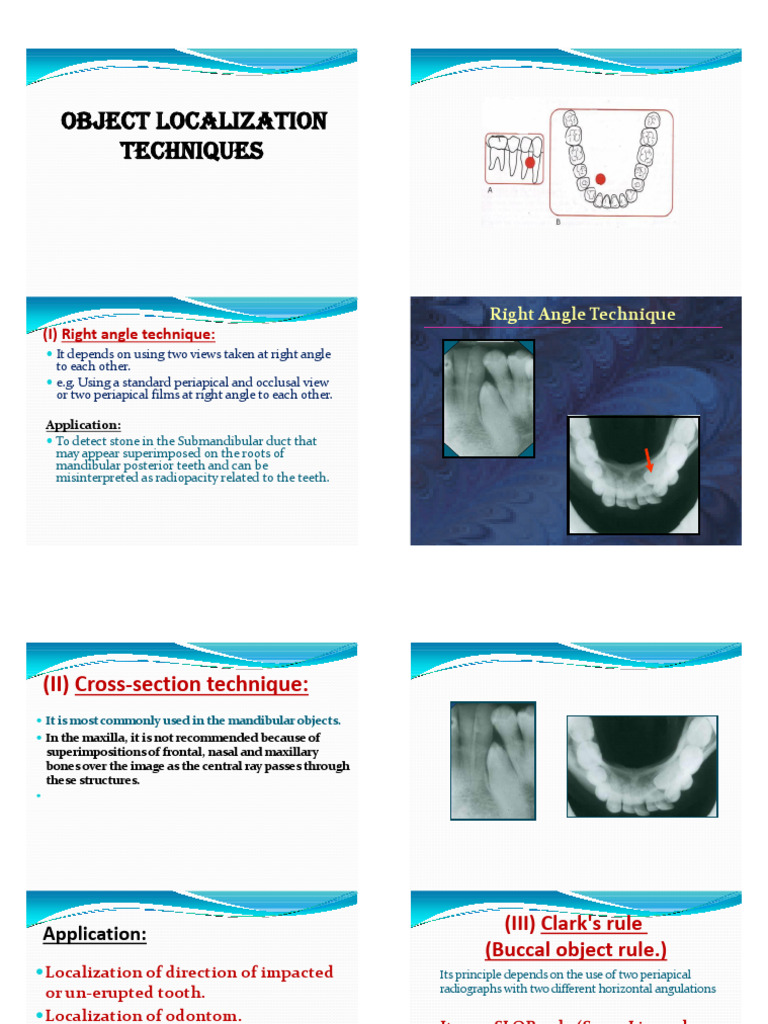 Object Localization Techniques in Dentistry | PDF | Dental Anatomy | Tooth