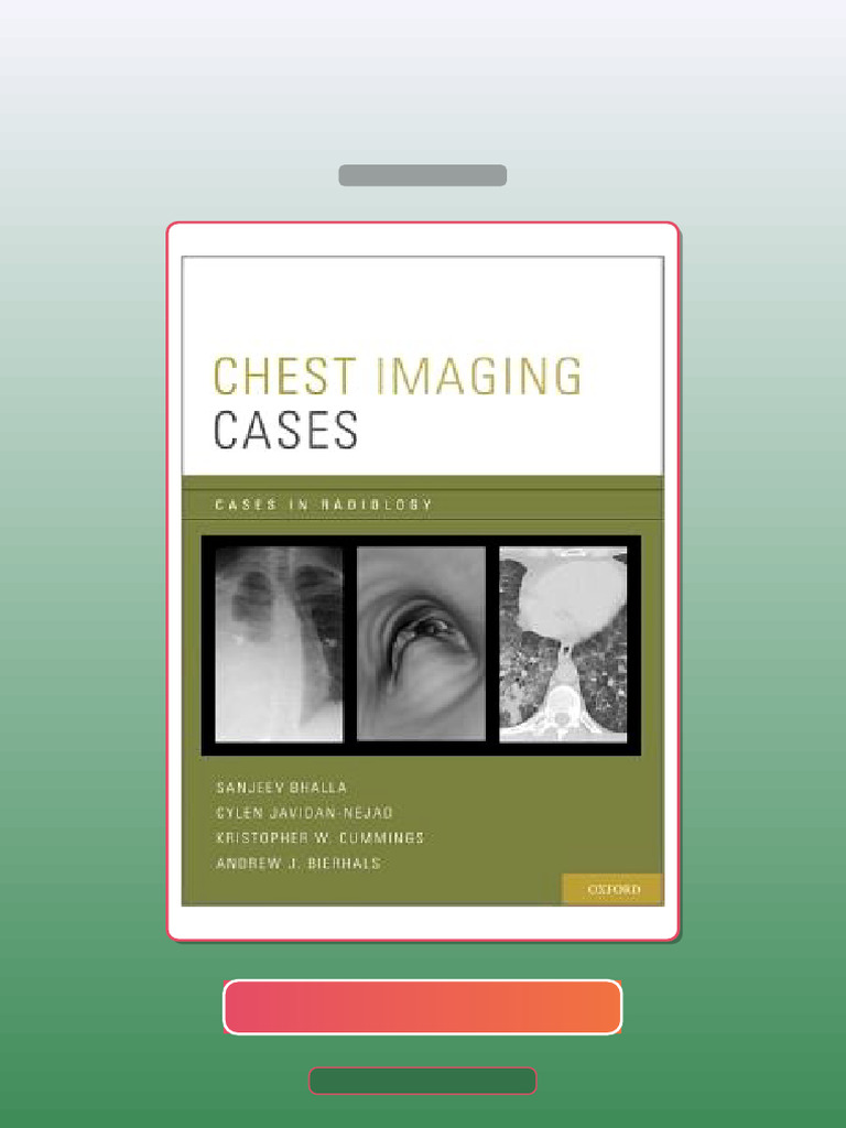Test Bank for Chest Imaging Cases Cases in Radiology | PDF | Multiple ...