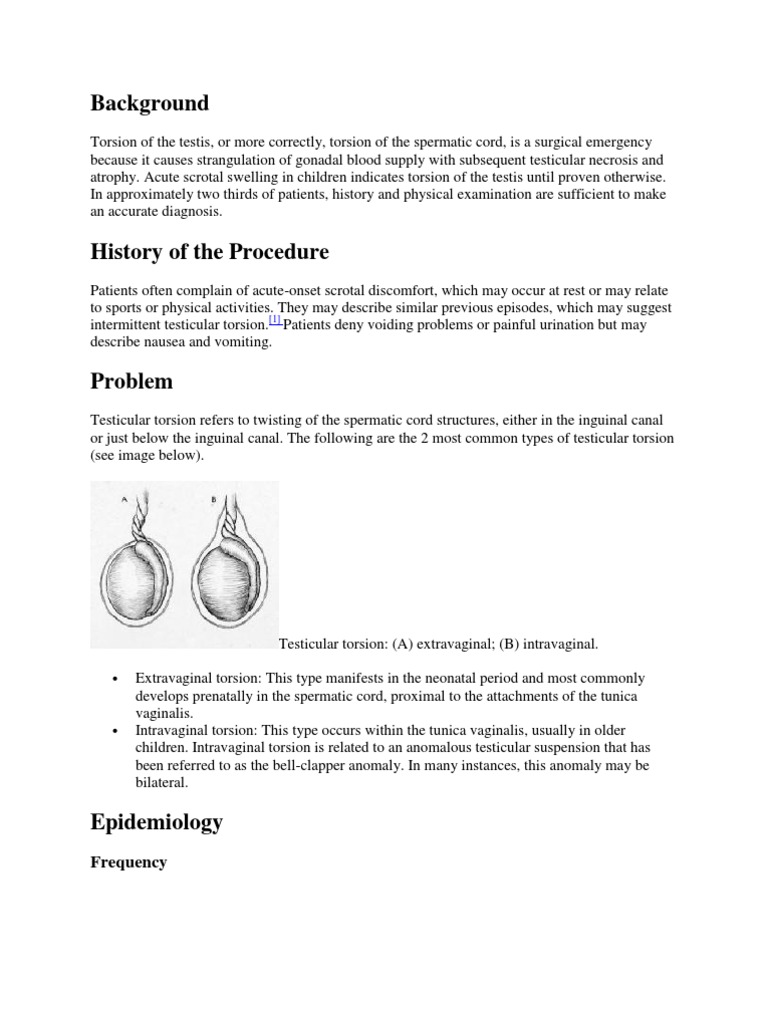 Testicular Torsion Intravaginal