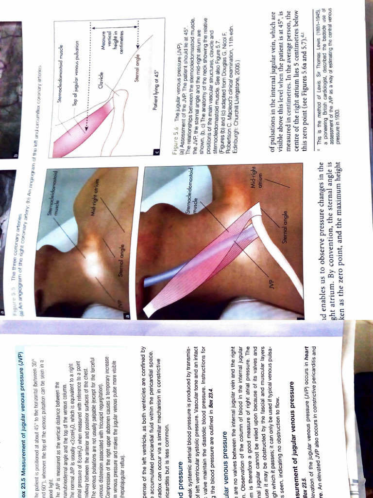 Understanding Jugular Venous Pressure Measurement | PDF ...