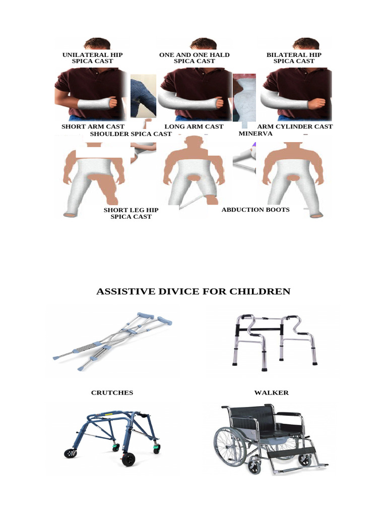 Brace and Cast | PDF | Musculoskeletal System | Limbs (Anatomy)