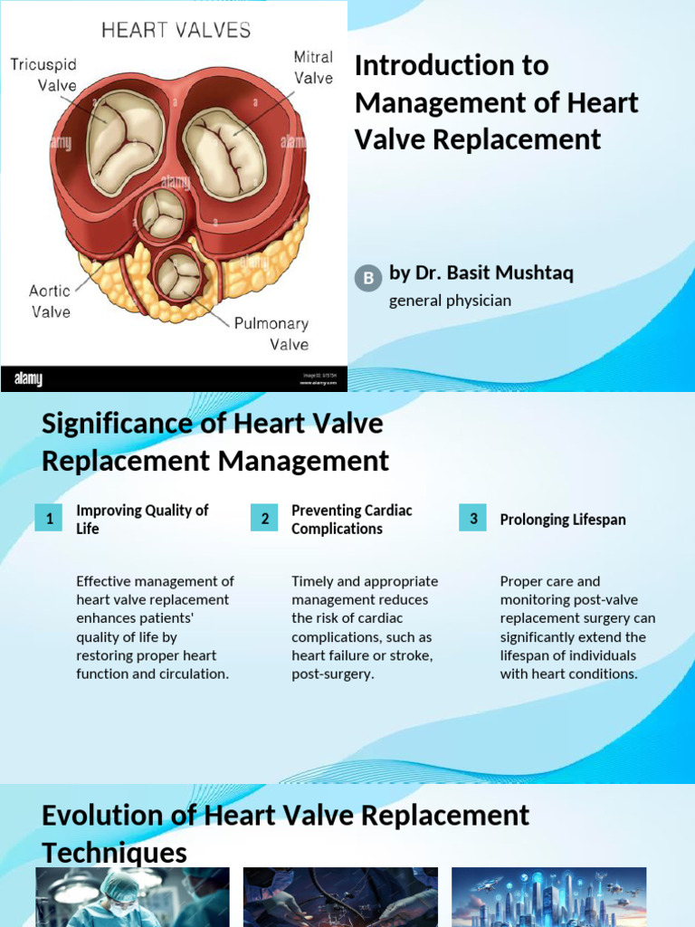 Management of Heart Value Replacement | PDF | Surgery | Cardiac Surgery