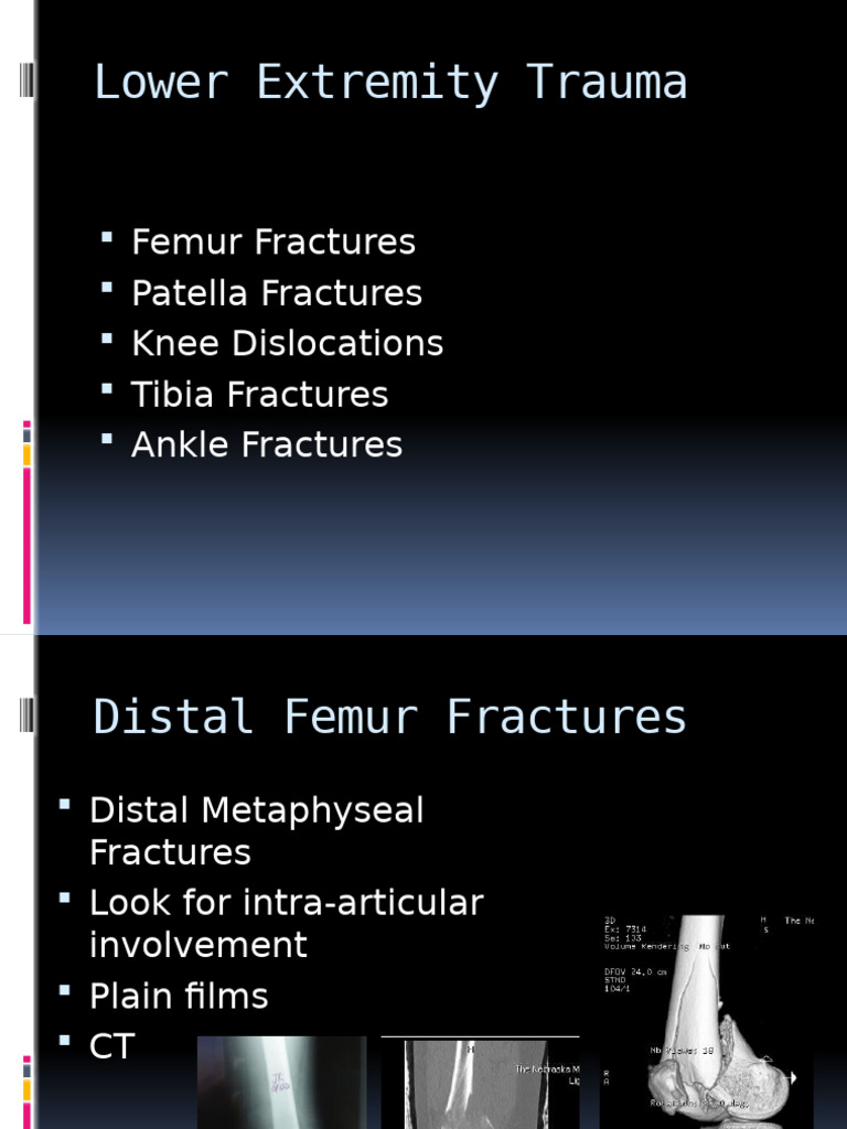 Comprehensive Guide to Lower Extremity Trauma | PDF | Ankle | Knee