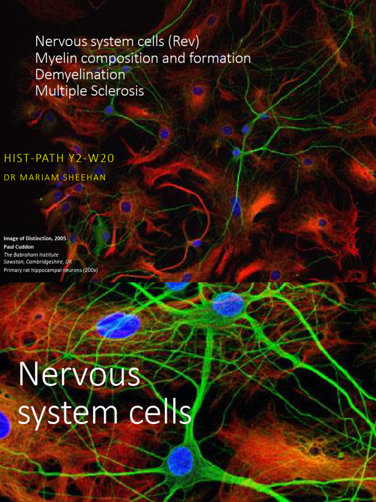 Myelin and Multiple Sclerosis Overview | PDF | Myelin | Axon