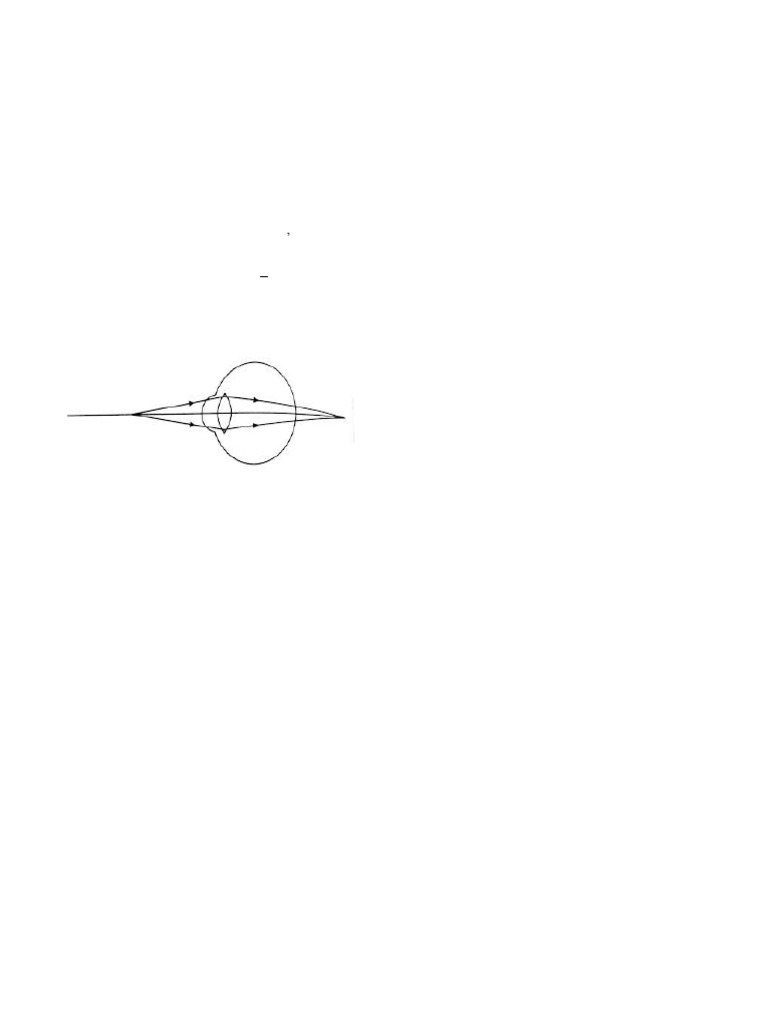 Human Eye: Vision Defects & Light Phenomena | PDF