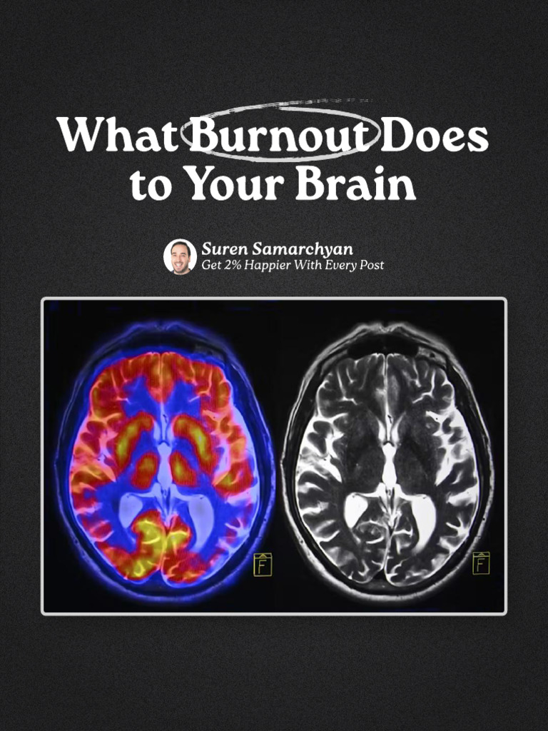 Burnout Biology | PDF