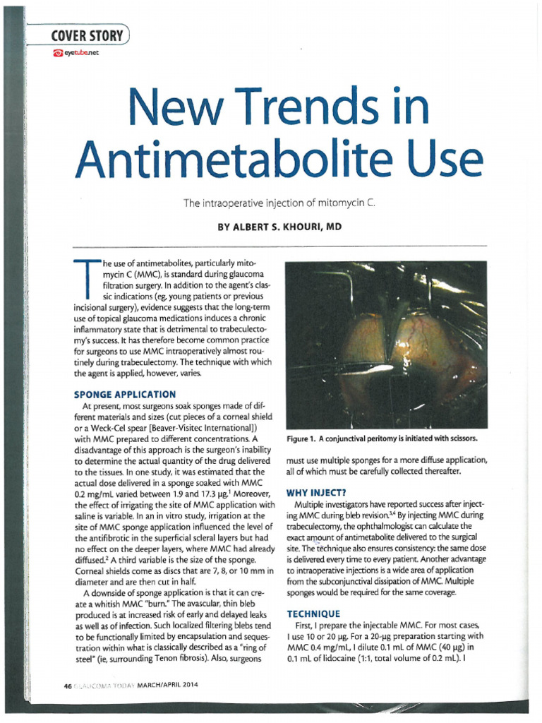 MMC Injection Article.pdf | PDF