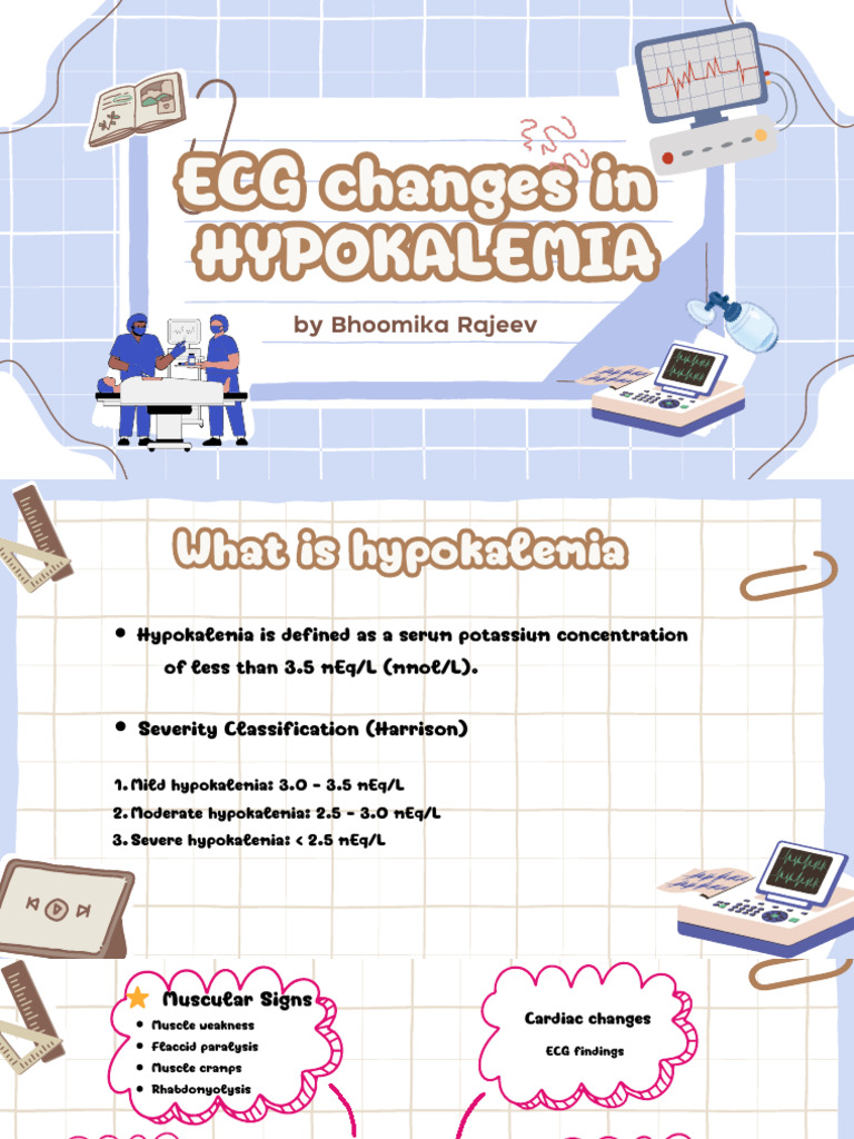 Ecg Changes in Hypokalemia | PDF | Potassium | Chemistry