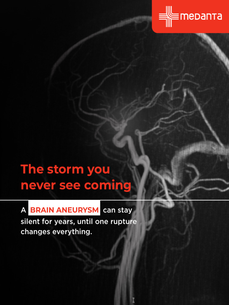 The Silent Threat_ Understanding Brain Aneurysms | PDF