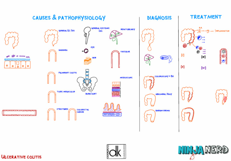 Ulcerative Colitis - Etiology, Pathophysiology, Clinical Features ...