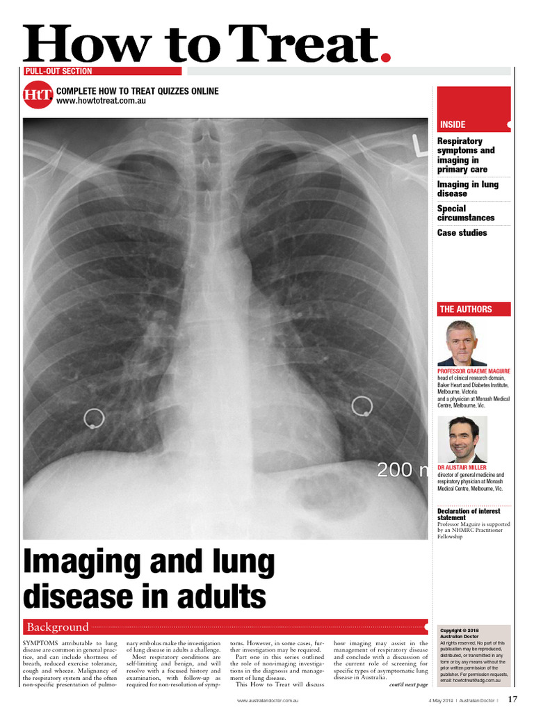 Imaging for Lung Disease in Primary Care | PDF | Ct Scan | Medical Imaging