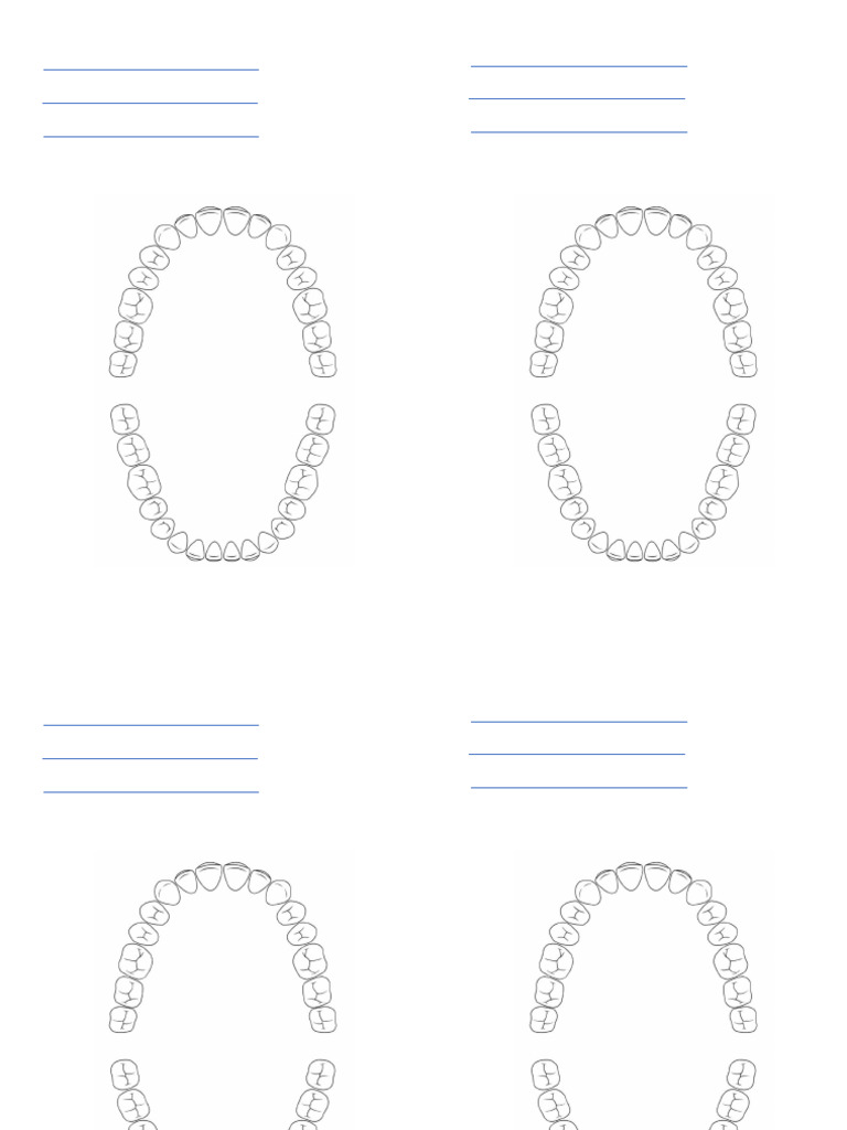 RPD Design Sheet | PDF
