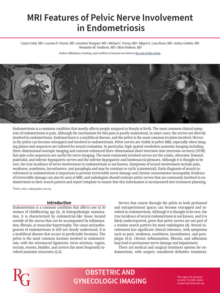 MRI Insights on Pelvic Nerve Endometriosis | PDF | Human Leg ...