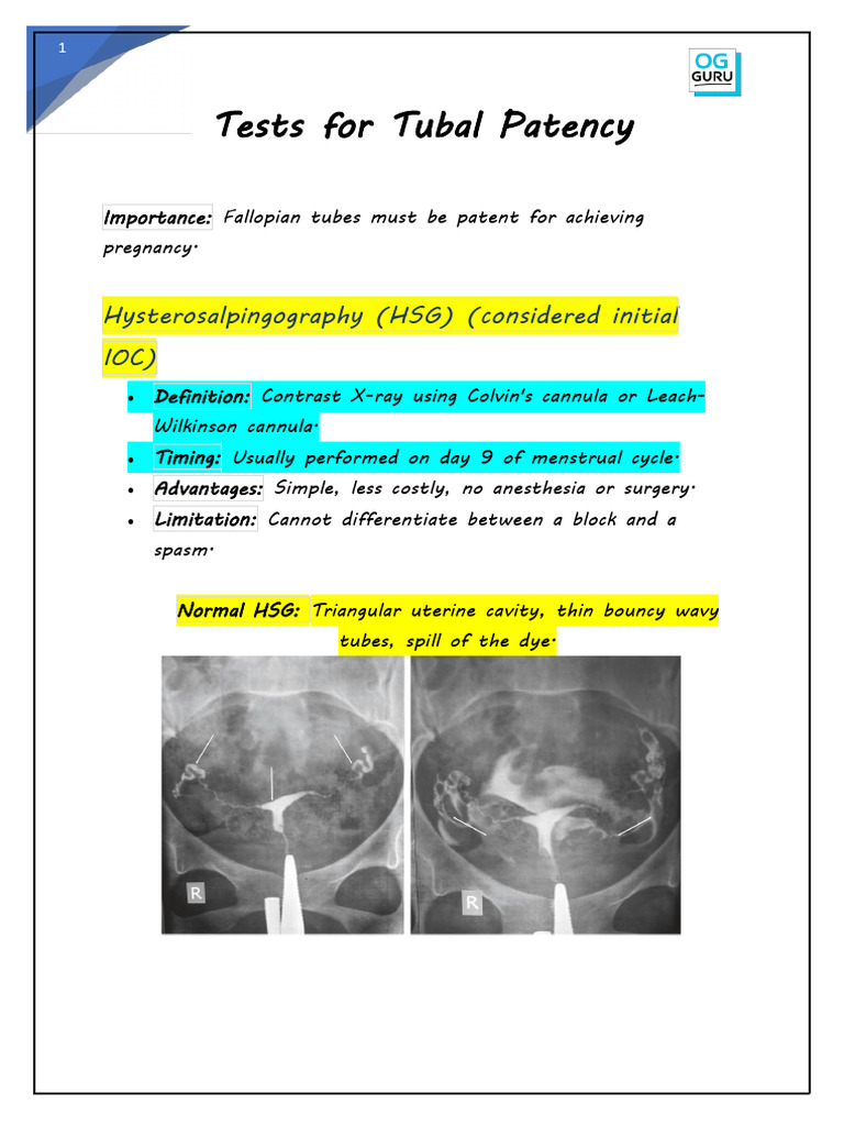 Tubal Patency Tests Explained | PDF