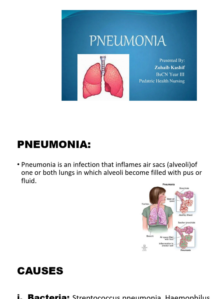 Pneumonia | PDF