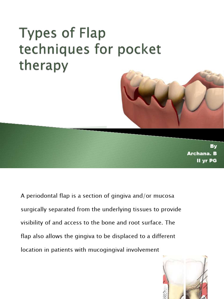 flaptechniquesforpockettherapy-4-190816125847 | PDF | Periodontology ...