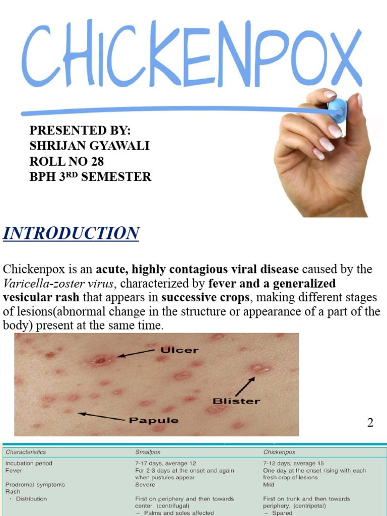 Chickenpox and Measles | PDF | Measles | Animal Diseases