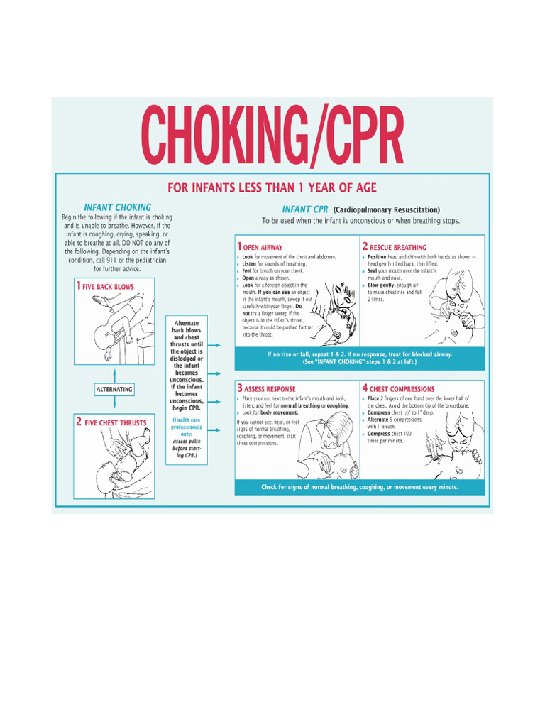 Choking For Infants | PDF