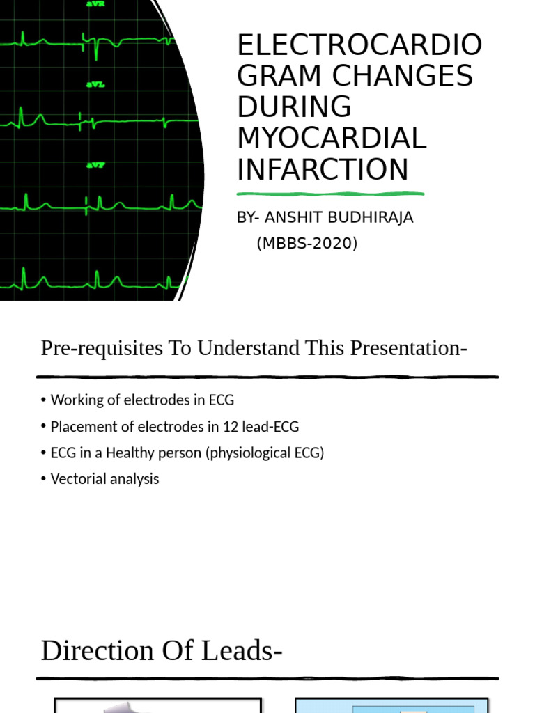 Electrocardiogram Changes During Myocardial Infarction | PDF ...