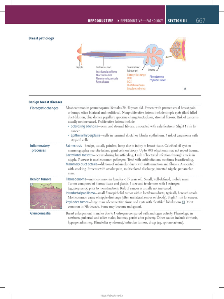 First Aid Step 1 2025 Breast | PDF | Breast Cancer | Neoplasms