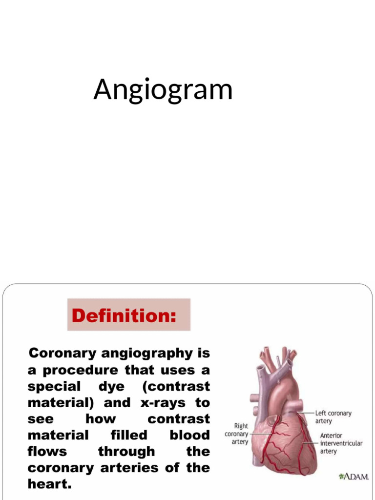 Angiogram | PDF