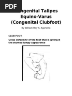 Clubfoot Presentation Foot Ankle