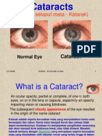 Cataract and Eye Care DCa
