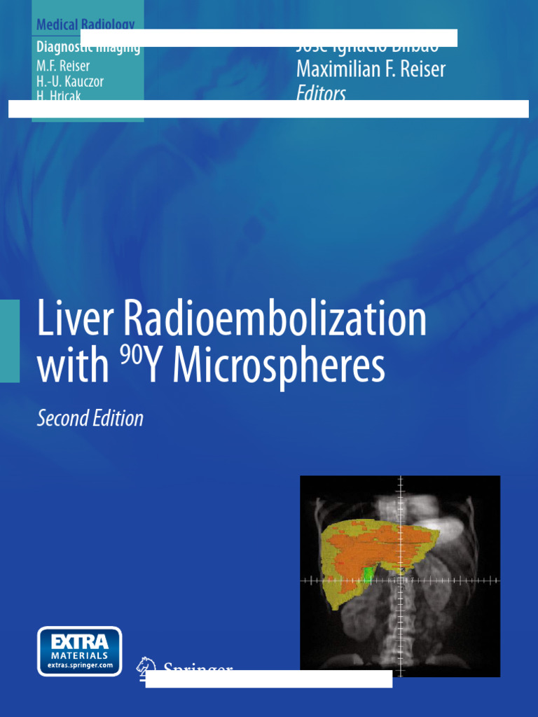Liver Radioembolization with 90Y Microspheres (2nd Edition) Bilbao PDF ...