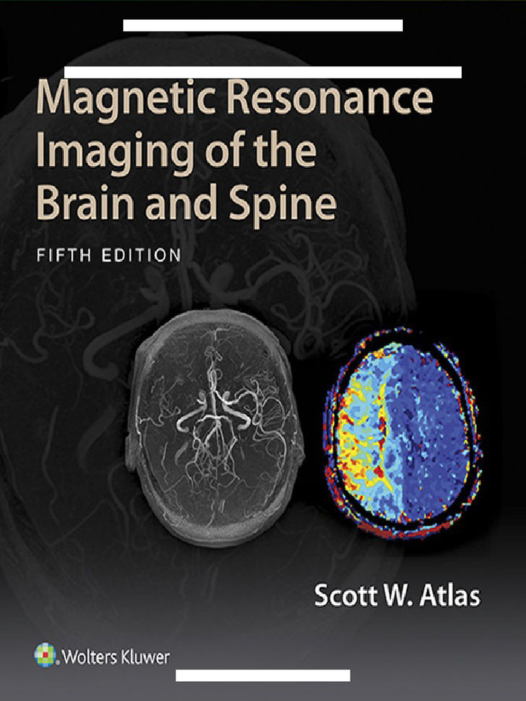Magnetic Resonance Imaging of The Brain and Spine (5th Edition) Atlas ...