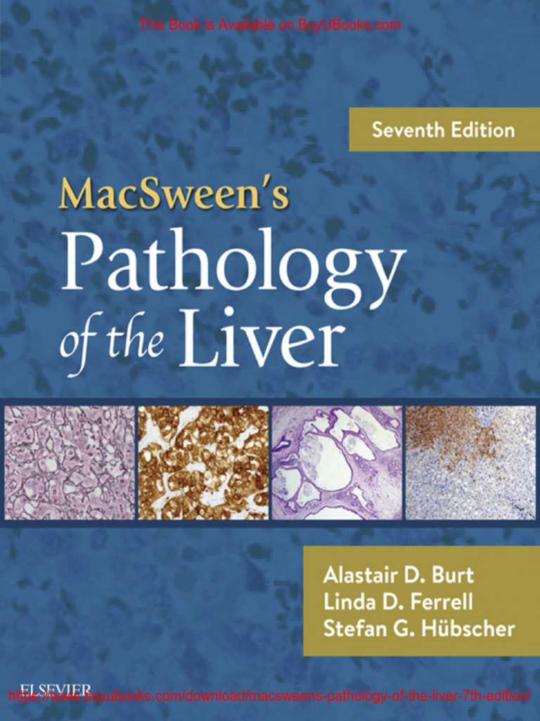 MacSween's Pathology of The Liver (7th Edition) PDF | PDF