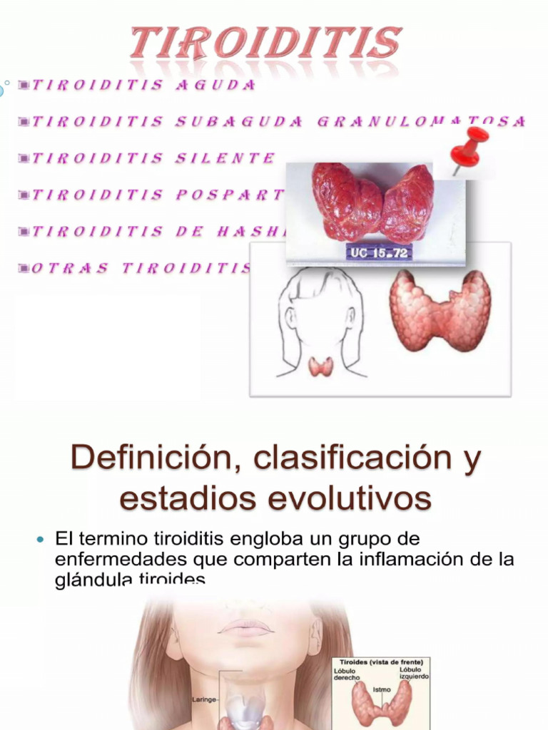 TIROIDITIS | PDF